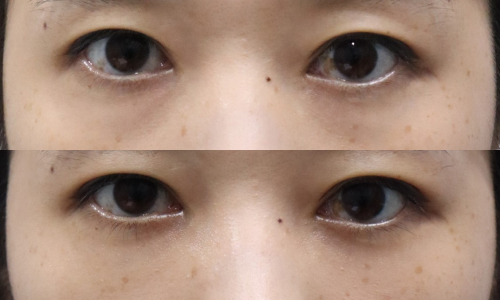슬라이드8
